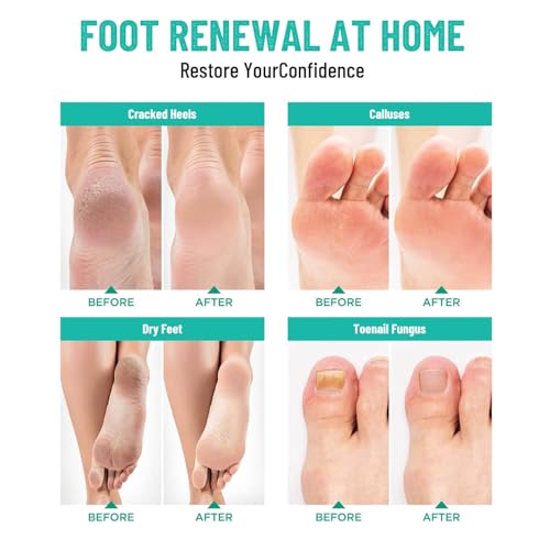 LUIFAC Epsom Salt Foot Soak Variety Pack - 12 Travel Packets (14.8 oz)