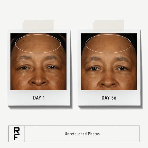 RODAN + FIELDS Redefine Daily Face Clay Cleanser (125 mL) | Advanced Skin Care | Exfoliating Face Wash & Face Mask for Sensitive Skin | Anti-Aging Face Cleanser for Women and Men