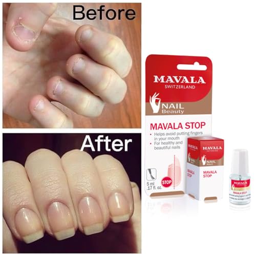 Mavala Stop Nail Biting Treatment Polish | Bitter Taste Deterrent