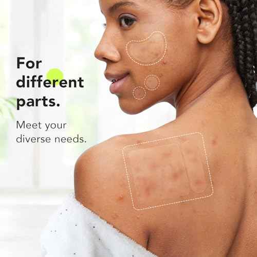 LitBear Large Pimple Patches (7 Sizes 112 Counts), Big Acne Patches, XL Hydrocolloid Bandages for Full Face, Forehead, Chin, Nose, Body, Back, Neck & Chest, Oval, Moon, Square hydrocolloid Patch