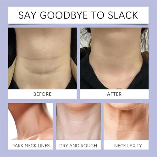 Collagen Neck Cream with Roller - Firming & Lifting Moisturizer (2Pcs)