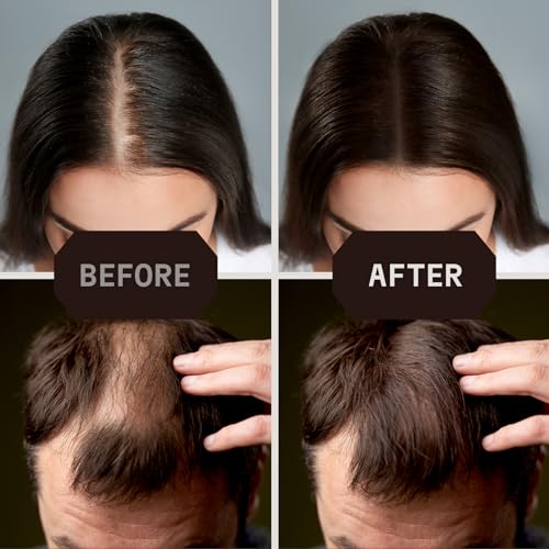 Striking Viking Hair Fibers Dark Brown 28g - Hair Thickening Powder