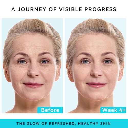 Retinol, Collagen & Hyaluronic Acid Face Cream - Anti-Aging Moisturizer for Face, Neck & D?collet? - Deep Nourishing, Firming & Wrinkle Reduction - Day & Night Use, 1.7 fl.oz.