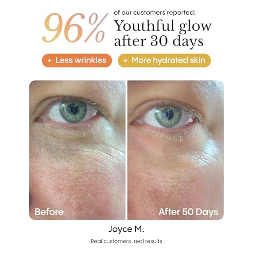 FR¨ªYA Organics Hyper Potent Dark Circles & Eye Bag Balm | Nourishing Formula with Arctic Arnica, Pomegranate & Rosehip | Water-Free Beeswax Treatment for Smoother, Refreshed Eyes | 15ml