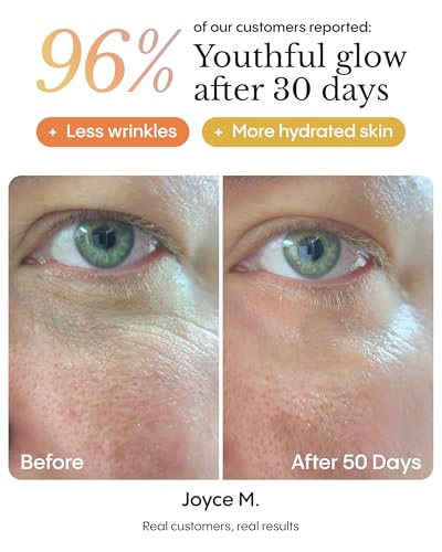 FRØYA Organics Dark Circles & Puffiness Eye Balm 0.5oz