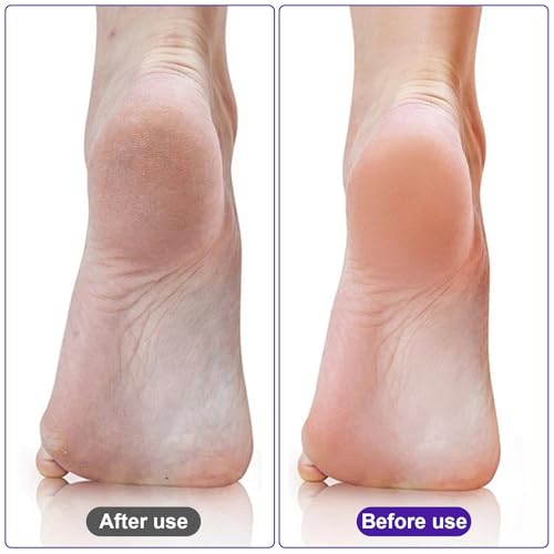 Uncle Yang Glass Foot Pumice Stone 4-Pack - Double-Sided Callus Remover