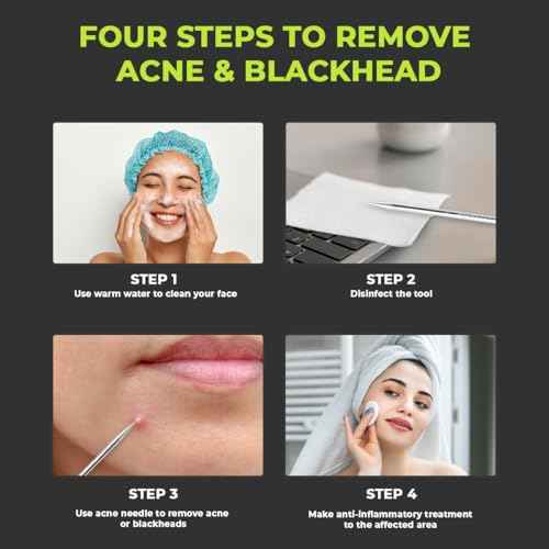 2 Pcs Pimple Extractor Tool Surgical Stainless Steel 410 | Comedone Extractor, Pimple Popper, Blackhead Remover for Face, Zit Popper, Pimple Needle for Acne Removal