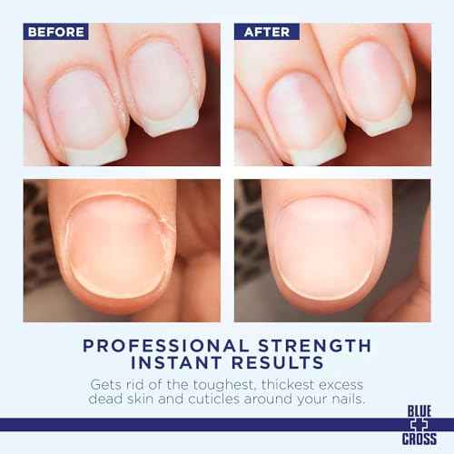 Cuticle Remover & Softener Liquid for Nails ? Blue Cross Professional Nail Care with Lanolin, Hydrating Treatment for Dry Cuticles & Hangnails, Made in USA, 8oz