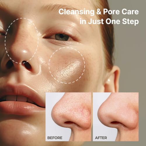 AVCA Blackhead Remover Cleansing Oil 300ml – K-Beauty Pore Care with PHA
