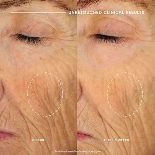 philosophy ultimate miracle worker nourish & rejuvenate face & neck cream - with patented retinol, ceramides & pro-collagen peptides - smoothes fine lines & wrinkles - fast absorbing moisturizer