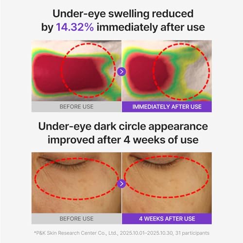 CENTELLIAN 24 360 Shot PDRN Glowing Eye Patch (6 Sets, 12ea) ? Instant Depuffing & Dark Circle Revitalizing Hydrogel Under Eye Patches with PDRN, Retinol & Glutathione, Cooling Eye Bags Treatment