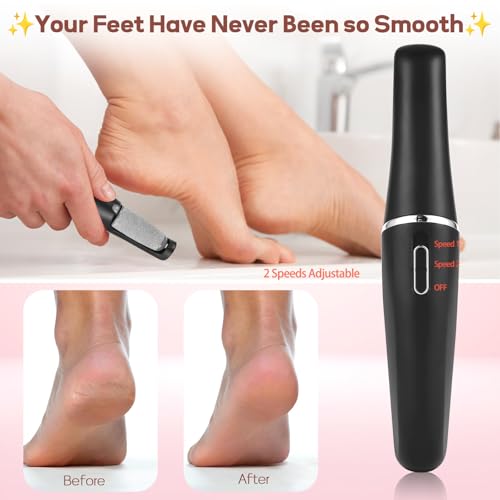 Electric Foot Callus Remover - Rechargeable Pedicure Tool for Smooth Feet