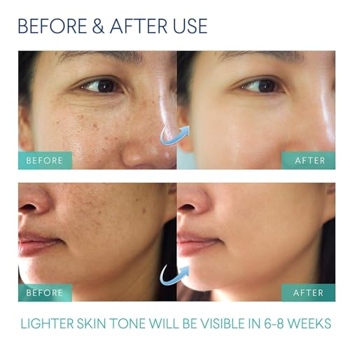 Razor Bumps & Ingrown Hair Treatment Serum for Face, Bikini, Underarm - Dinocook
