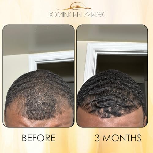 Dominican Magic Hair Growth Scalp Tonic, 2.01 Oz