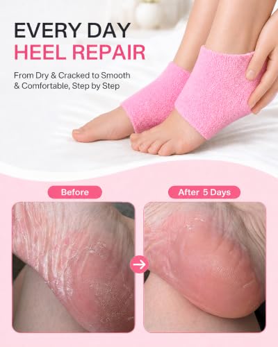 Originbuty Pink Moisturizing Heel Socks for Dry Cracked Feet, Silicone Foot Spa Treatment