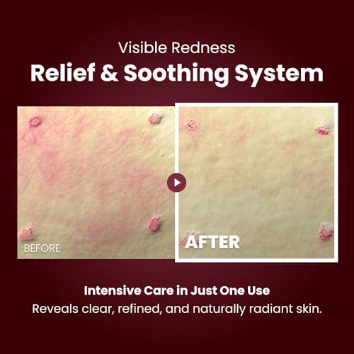 KOPHER Curepair Melder SOS Cream?Peptide Repair Night Cream for Radiance, Recovery & Post-Procedure Care | Advanced Skincare, Valentine Gifts for Women,Valentine Gifts for Coworkers