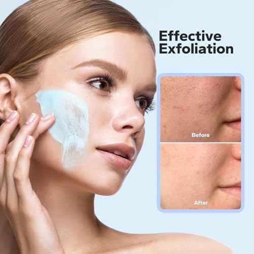 Microdermabrasion Face Scrub (4.23 Oz), Exfoliating Face Wash, Facial Scrub Exfoliator with Natural Pumice, Peptides & Botanical Extracts, Facial Exfoliator for Smooth and Refreshed Skin