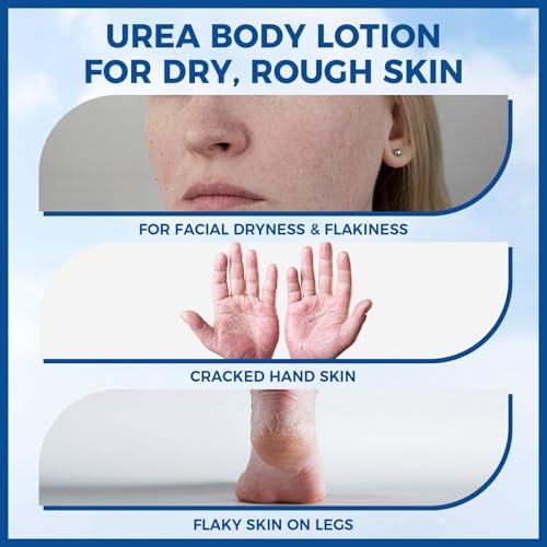 OUKEYA 10% Urea Body Lotion for Dry Skin - 11.28 oz Moisturizer
