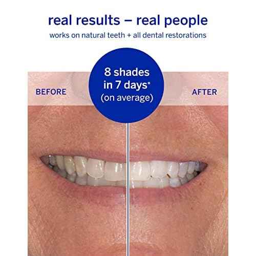 Whitening Strips, Superstrips by Supersmile, Professional Teeth Whitening Strips, Enamel Safe Teeth Whitener for Sensitive Teeth