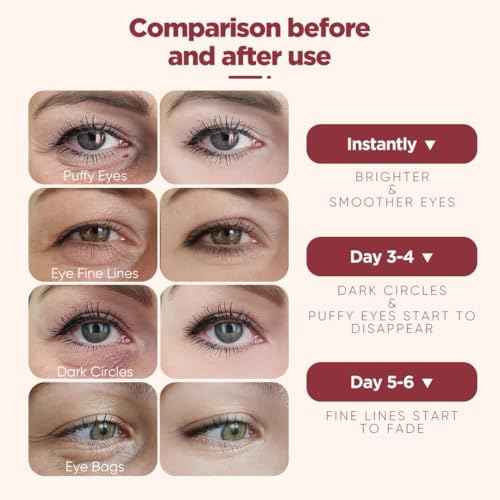 Under Eye Patches (20 Pairs), pink Hyaluronic Acid Eye Patches For Puffy Eyes, Dark Circles, Puffiness, Refresh,Revitalizing, Wrinkles, Anti Aging & Face Moisturizer For Women and Men