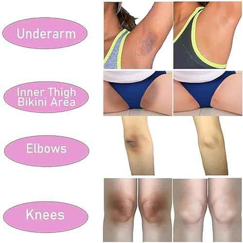 Intimate Areas Skin Lightening Cream for Private Parts, Underarm, Intimate Area, Bikini Area, Inner Thighs, Knees, Elbows, Bleach Skin Bleaching Whitening Cream For Body