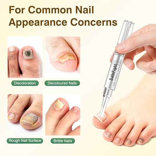 SafeFight Toenail Fungus Treatment Extra Strength - 3PCS Nail Repair Pen with 25% Undecylenic Acid