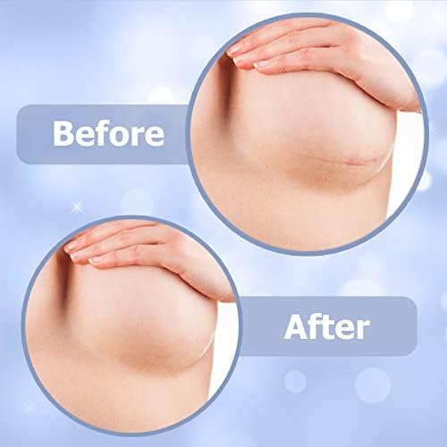 Breast Augmentation Must Haves Post Surgery - Breast Reduction Recovery Supplies After Surgery Needs - Silicone Scar Sheets for Surgical Scars - Comfortable Under Post op Bra (4PCS)…