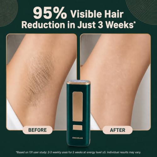 ENCHELYR IPL Hair Removal for Women with Ice Cooling – 5 Levels, Full-Body Kit