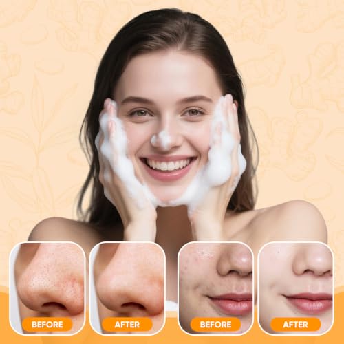 Turmeric Face Wash Set with Soap & Oil for Acne & Radiant Skin – Femani