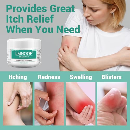 LMNOOP Anti Itch Cream - Extra Strength Relief for Eczema & Rash