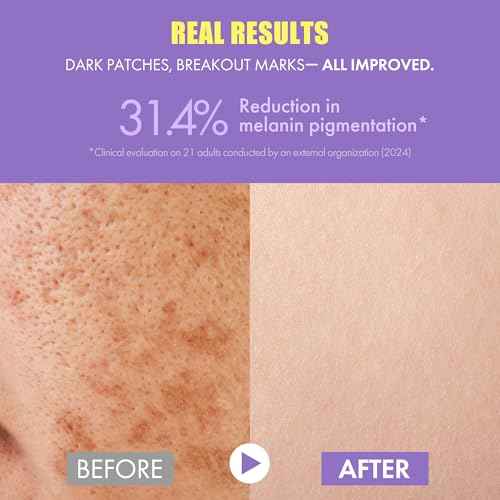 Glutathione Vitamin C Serum 50ml - Step-by-Step Discoloration Correcting Serum with Hyaluronic Acid & Niacinamide - Moisturizing & Hydrating K Beauty Skin Care (1.69 fl oz)