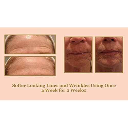 DIAMONDBUFF Microderm Exfoliation Tool for at Home Glowing and Radiant Skin | Reduce Acne, Fine Lines, Wrinkles, & Provide a Velvety Smooth Complexion with Diamond Microdermabrasion