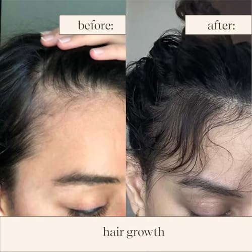 Champi Hair Oil & Moonlight Scalp Serum Duo for Hair Growth