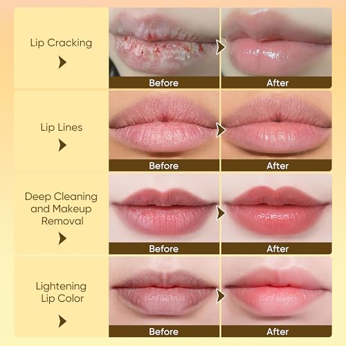 Lip Serum & Bubble Lip Mask, with Hyaluronic Acid, Vitamin C & Squalane Plumping Lip Treatment, Nourishing Overnight Lip Balm, Hydrating, Exfoliating Lip Scrub Alternative (0.14Fl.Oz, 3-Piece)