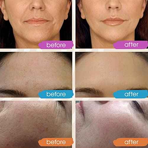 GLEOW Retinol Serum for Face, Vitamin C with Hyaluronic Acid Face Serum for Women and Men, Glow Total Package Skin Care Set, Targets Appearance of Uneven Skin Tone and Dryness 3x2 oz