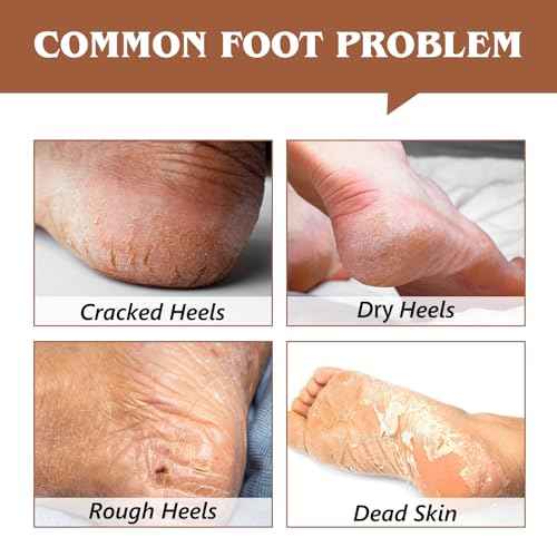Intensive Foot Repair, Dry & Cracked Heel Treatment Balm Stick for Instant & Deep Moisturizing & Hydrating, with Aloe, Coconut Oil, Hyaluronic Aicd, Olive Oil, Coconut Scent, 2.46 oz/70 g