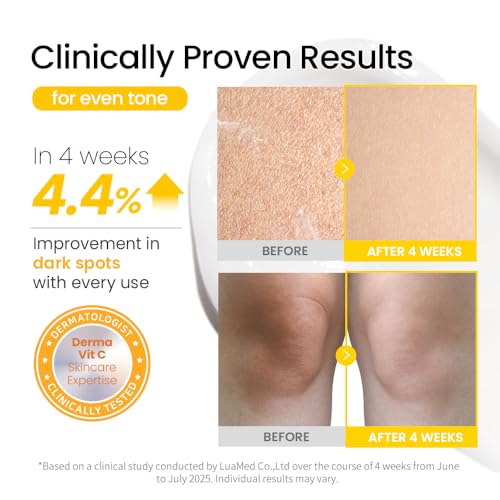 #OOTD Intensive Moisturizing Body Lotion, 750ml (25.36 fl oz.) Gentle Daily Moisturizer with Hyaluronic Acid & Collagen for Dry & Sensitive Skin (Vitaminc C Body Lotion)