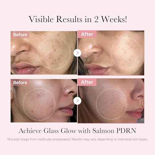 medicube Salmon DNA PDRN Trial Kit | Glass Glow Mini Skincare Set with Toner, Serum & Sheet Mask for Hydrating, Firming, Moisturizing |Gift & Travel Essentials for Women & Girls | Korean Skincare