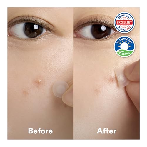 Cordiale Centella Pimple Patches with Salicylic Acid & Hyaluronic Acid, Hydrocolloid Acne Spot Patches for Face & Chin, Invisible Zit/Blemish Stickers, Korean Skin Care (78 Count, 2 Sizes)