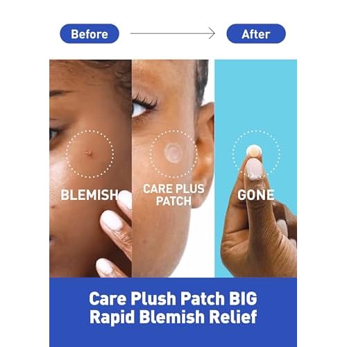 OLIVE YOUNG Care Plus Spot Patch | Hydrocolloid Acne Korean Spot Patch to Cover Zits, Pimples and Blemishes, for Troubled Skin and Face (Hydrocolloid, 102 Count (Pack of 1))