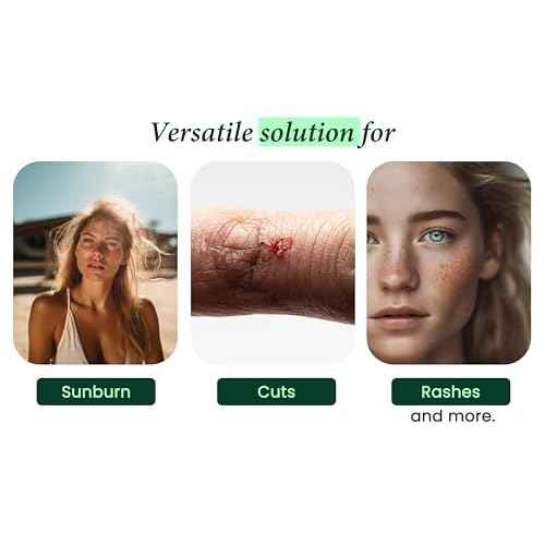 Allurials 99.75% Pure & Organic Aloe Vera Spray, Clinically tested & Dermatologist approved, Hydrates & Heals Dry & Damaged Skin & Hair- 12 Oz