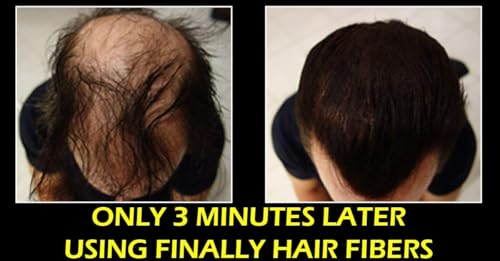 Finally Hair Fiber Lock Strong Hold Spray for Hair Fibers 120ml