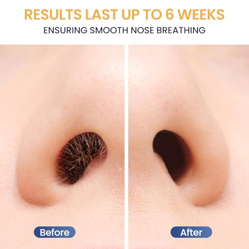 Nose Hair Wax Kit for Men, Nose Wax Removal with 100 g Wax, 40 Applicators, 15-20 Times, Ear Nasal Hair Waxing For Men and Women, Usb Rapid Heating, Constant Temperature, Painless, Black