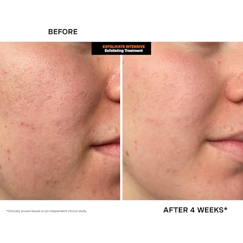 Kate Somerville ExfoliKate Intensive Exfoliating Treatment 2oz