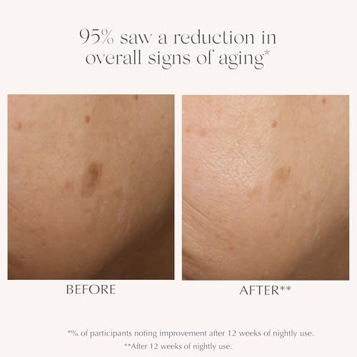 EXUVIANCE AGE REVERSE+ Advanced Renewal Retinol Overnight Serum Anti-Aging Wrinkle Reducer with 0.3% Pure Retinol, Niacinamide, NeoGlucosamine, Hyaluronic Acid, & Centella Asiatica, 30ml/1 fl oz