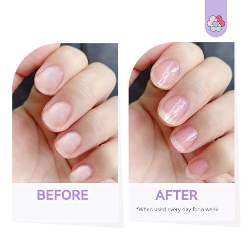 SAVILAND 3-in-1 Nail Strengthener Kit with Vitamin E & Castor Oil for Damaged Nails Repair, Growth & Nourishment