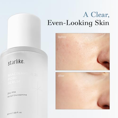 starlike Niacinamide 21% Pore Serum I 1.69 Fl oz (50ml) I Korean Moisturizing & Oil Balancing Facial Serum I Soothing, Lightweight & Fresh Finish I 17 Amino Acids & Hyaluronic I Glowing Skin Care