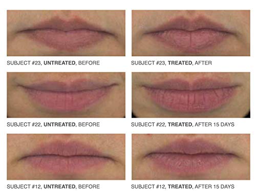 PRO Restørsea Lip Magic with Vibransea Complex - Lip Enhancer for Softer, Smoother, Plumper-looking Lips in 15 Days/Paraben, Sulfate, and Cruelty-free