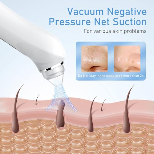 Ottleba HD Camera Blackhead Remover with 3 Suction Modes