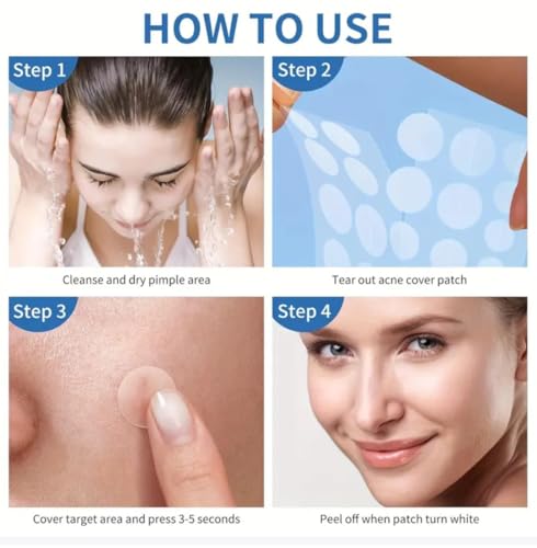 Invisible Acne Patches 400 Count - Fast-Acting Pimple Treatment